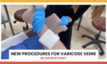 New Procedures for Varicose Veins